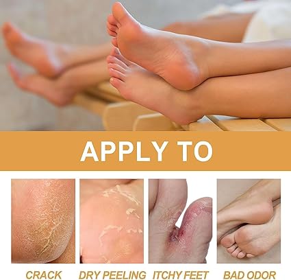 🔥👉DILE ADIOS A LOS PIES CALLOSOS 🦶CONZAKDAVI REMOVAL SPRAY ELIMINADOR DE CALLOS 🤩💫