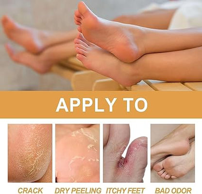 🔥👉DILE ADIOS A LOS PIES CALLOSOS 🦶CONZAKDAVI  REMOVAL SPRAY ELIMINADOR DE CALLOS 🤩💫
