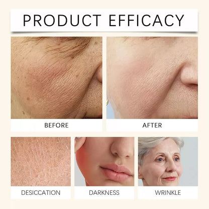🤯LLEVALA ANTES DE QUE SE AGOTE⚡🔥 OFERTA DE CREMA FACIAL DE SEBO ELVI GOODS DE RES 👌PARA TENER UNA PIEL DESLUMBRANTE🤩