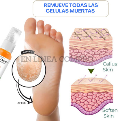 🔥👉DILE ADIOS A LOS PIES CALLOSOS 🦶CONZAKDAVI  REMOVAL SPRAY ELIMINADOR DE CALLOS 🤩💫