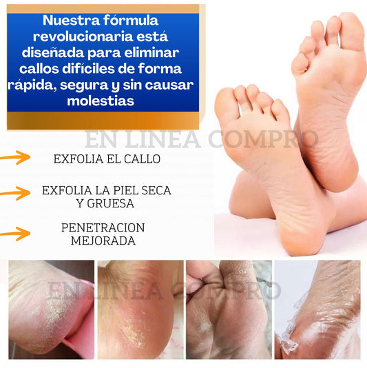 🔥👉DILE ADIOS A LOS PIES CALLOSOS 🦶CONZAKDAVI  REMOVAL SPRAY ELIMINADOR DE CALLOS 🤩💫
